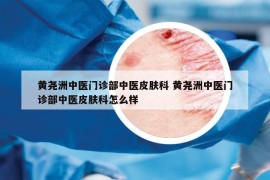 黃堯洲中醫(yī)門診部中醫(yī)皮膚科 黃堯洲中醫(yī)門診部中醫(yī)皮膚科怎么樣