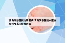 青島海慈醫(yī)院治銀屑病 青島海慈醫(yī)院中醫(yī)皮膚科專家門診時間表