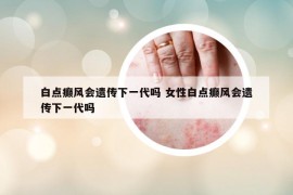 白點(diǎn)癲風(fēng)會(huì)遺傳下一代嗎 女性白點(diǎn)癲風(fēng)會(huì)遺傳下一代嗎