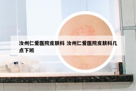汝州仁愛醫(yī)院皮膚科 汝州仁愛醫(yī)院皮膚科幾點(diǎn)下班