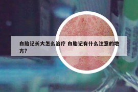 白胎記長(zhǎng)大怎么治療 白胎記有什么注意的地方?
