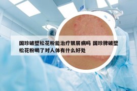 國珍破壁松花粉能治療銀屑病嗎 國珍牌破壁松花粉喝了對人體有什么好處