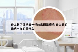 身上長了像疤痕一樣的東西是癬嗎 身上長的像疤一樣的是什么