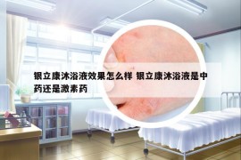 銀立康沐浴液效果怎么樣 銀立康沐浴液是中藥還是激素藥