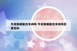 牛皮膚癬能吃羊肉嗎 牛皮膚癬能吃羊肉嗎百度百科