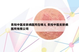 貴陽中醫(yī)皮膚病醫(yī)院在哪兒 貴陽中醫(yī)皮膚病醫(yī)院有限公司
