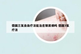 德國三氧自血療法能治愈銀屑病嗎 德國3氧療法