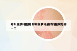 鄭州皮膚科醫(yī)院 鄭州皮膚科最好的醫(yī)院是哪一個