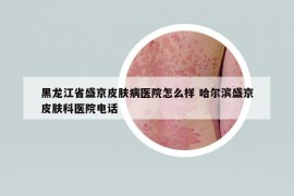 黑龍江省盛京皮膚病醫(yī)院怎么樣 哈爾濱盛京皮膚科醫(yī)院電話