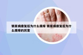 銀屑病康復后為什么瘙癢 銀屑病康復后為什么瘙癢的厲害