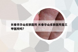 長(zhǎng)春市華山皮膚醫(yī)院 長(zhǎng)春華山皮膚醫(yī)院是三甲醫(yī)院?jiǎn)?