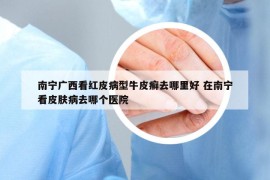 南寧廣西看紅皮病型牛皮癬去哪里好 在南寧看皮膚病去哪個醫(yī)院