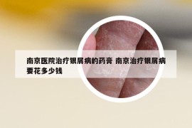 南京醫(yī)院治療銀屑病的藥膏 南京治療銀屑病要花多少錢