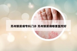 蘇州銀屑病專科門診 蘇州銀屑病哪里醫(yī)院好
