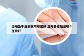 洛陽(yáng)治牛皮癬醫(yī)院哪家好 洛陽(yáng)看皮膚病哪個(gè)醫(yī)院好