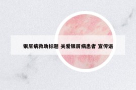 銀屑病救助標(biāo)題 關(guān)愛銀屑病患者 宣傳語