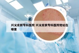 興義皮膚?？漆t(yī)院 興義皮膚?？漆t(yī)院地址在哪里