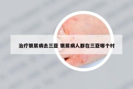 治療銀屑病去三亞 銀屑病人都在三亞哪個(gè)村