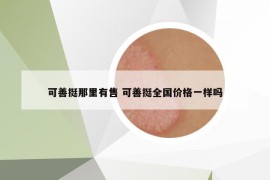 可善挺那里有售 可善挺全國價(jià)格一樣嗎
