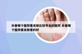 長春哪個醫(yī)院看皮膚比較專業(yè)的醫(yī)院 長春哪個醫(yī)院看皮膚看的好