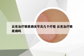 云克治療銀屑病關(guān)節(jié)炎幾個(gè)療程 云克治療銀屑病嗎