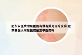 肥東安醫(yī)大附屬醫(yī)院有沒有激光治療皮癬 肥東安醫(yī)大附屬醫(yī)院是三甲醫(yī)院嗎