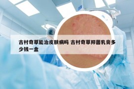 古村奇草能治皮膚病嗎 古村奇草抑菌乳膏多少錢一盒
