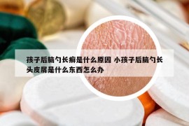 孩子后腦勺長癬是什么原因 小孩子后腦勺長頭皮屑是什么東西怎么辦