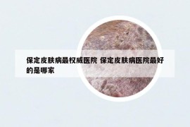 保定皮膚病最權(quán)威醫(yī)院 保定皮膚病醫(yī)院最好的是哪家