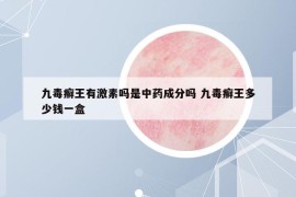 九毒癬王有激素嗎是中藥成分嗎 九毒癬王多少錢一盒