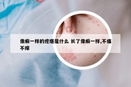 像癬一樣的疙瘩是什么 長了像癬一樣,不痛不癢