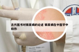 古代醫(yī)書對銀屑病的論述 銀屑病在中醫(yī)學中稱作