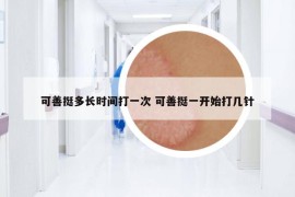 可善挺多長時(shí)間打一次 可善挺一開始打幾針