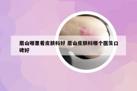 眉山哪里看皮膚科好 眉山皮膚科哪個(gè)醫(yī)生口碑好