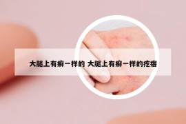 大腿上有癬一樣的 大腿上有癬一樣的疙瘩
