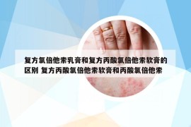 復方氯倍他索乳膏和復方丙酸氯倍他索軟膏的區(qū)別 復方丙酸氯倍他索軟膏和丙酸氯倍他索