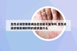 急性點(diǎn)滴型銀屑病治愈后能不復(fù)發(fā)嗎 急性點(diǎn)滴狀銀屑病好轉(zhuǎn)的癥狀是什么
