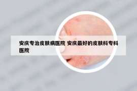 安慶專治皮膚病醫(yī)院 安慶最好的皮膚科?？漆t(yī)院