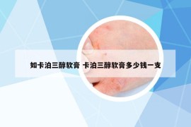 如卡泊三醇軟膏 卡泊三醇軟膏多少錢(qián)一支