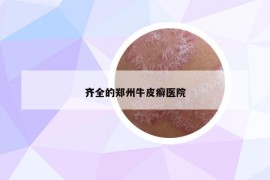 齊全的鄭州牛皮癬醫(yī)院