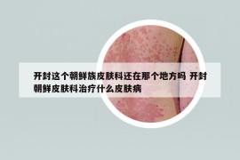 開封這個(gè)朝鮮族皮膚科還在那個(gè)地方嗎 開封朝鮮皮膚科治療什么皮膚病