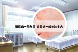 銀屑病一般年齡 銀屑病一般年齡多大