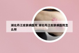 湖北丹江皮膚病醫(yī)院 湖北丹江皮膚病醫(yī)院怎么樣