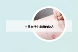 中醫(yī)治療牛皮癬的處方