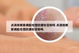點滴妝銀屑病能吃德欣康松花粉嗎 點滴妝銀屑病能吃德欣康松花粉嗎