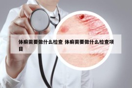 體癬需要做什么檢查 體癬需要做什么檢查項目