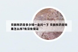 貝膚邦藥膏多少錢一盒問一下 貝膚邦藥膏效果怎么樣?有沒有保證
