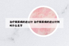 治療銀屑病的進口針 治療銀屑病的進口針劑叫什么名字