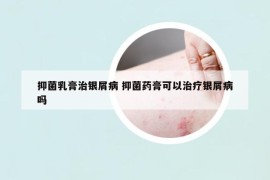 抑菌乳膏治銀屑病 抑菌藥膏可以治療銀屑病嗎