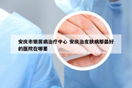 安慶市銀屑病治療中心 安慶治皮膚病那最好的醫(yī)院在哪里